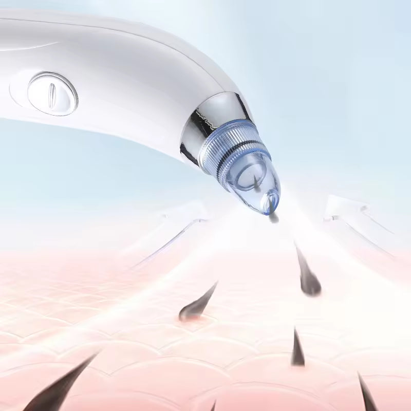 Moonova™ | Derma-Suction Blackhead Remover