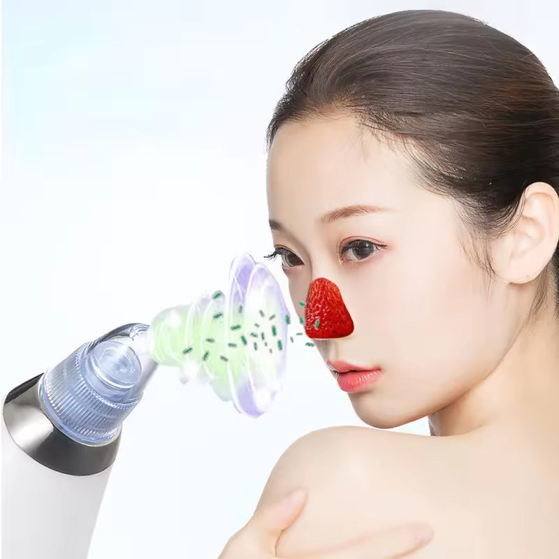 Moonova™ | Derma-Suction Blackhead Remover