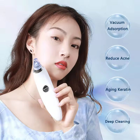 Moonova™ | Derma-Suction Blackhead Remover